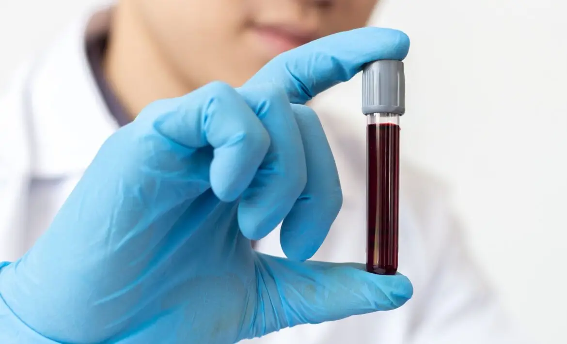 Lab technician holding a vial of blood.