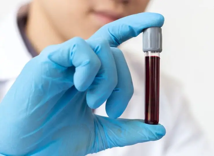 Lab technician holding a vial of blood.